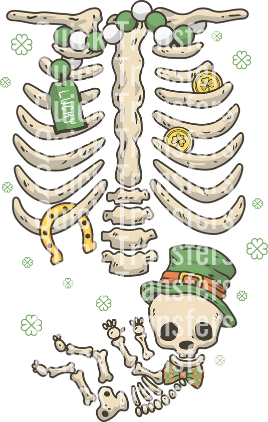 A skeleton wearing a bow tie and green hat holds a dollar-sign bag amidst clovers. The background showcases "Quick Transfers." Product: Charming Skeleton Baby Birth Announcement - Ready To Press DTF Transfer by Quick Transfers.